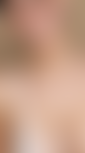Geblurrte Content-Vorschau