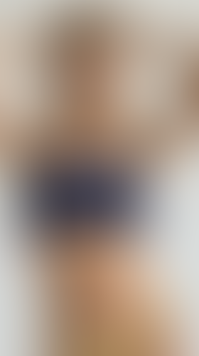 Geblurrte Content-Vorschau