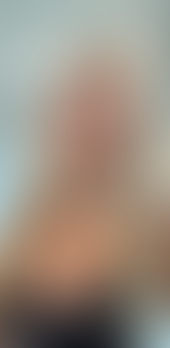 Geblurrte Content-Vorschau