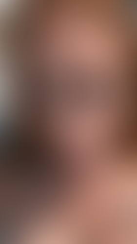 Geblurrte Content-Vorschau