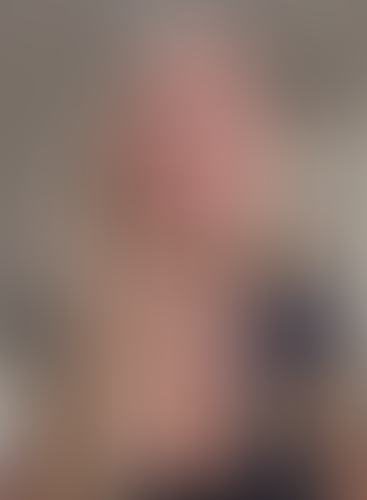 Geblurrte Content-Vorschau
