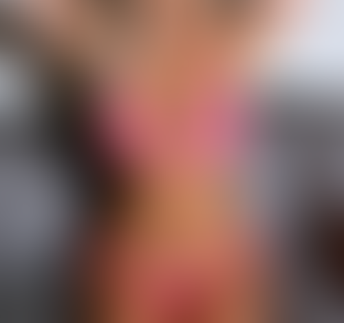 Geblurrte Content-Vorschau