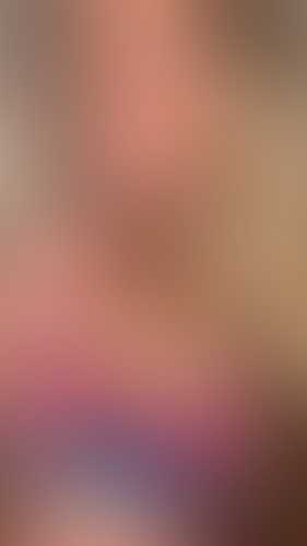 Geblurrte Content-Vorschau