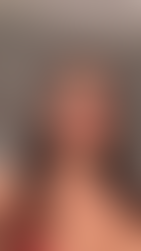 Geblurrte Content-Vorschau