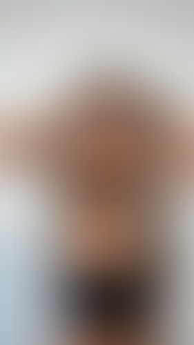 Geblurrte Content-Vorschau