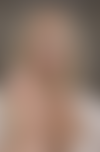 Geblurrte Content-Vorschau