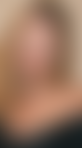 Geblurrte Content-Vorschau