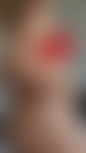 Geblurrte Content-Vorschau