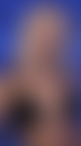 Geblurrte Content-Vorschau