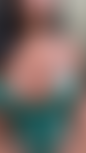 Geblurrte Content-Vorschau