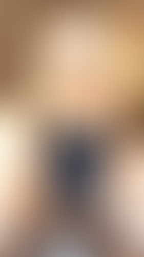Geblurrte Content-Vorschau