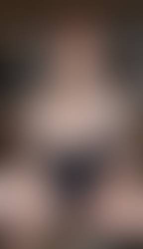 Geblurrte Content-Vorschau