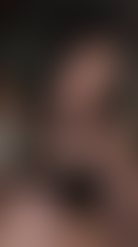 Geblurrte Content-Vorschau