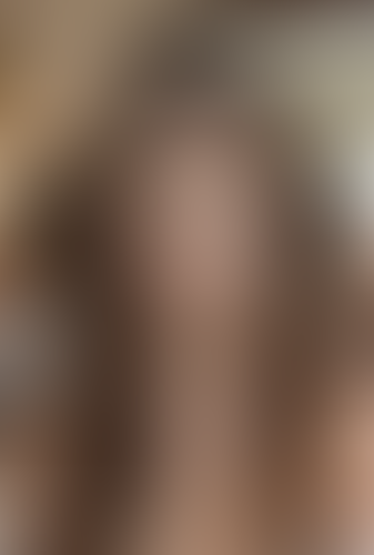 Geblurrte Content-Vorschau