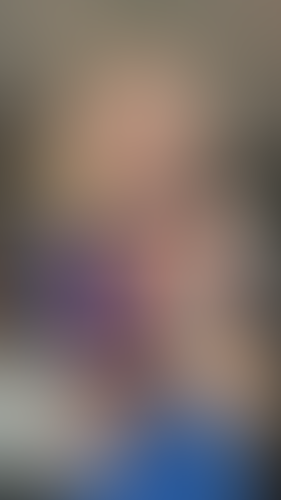 Geblurrte Content-Vorschau