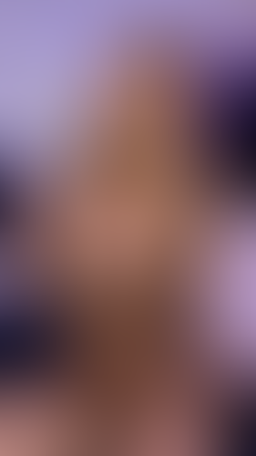 Geblurrte Content-Vorschau