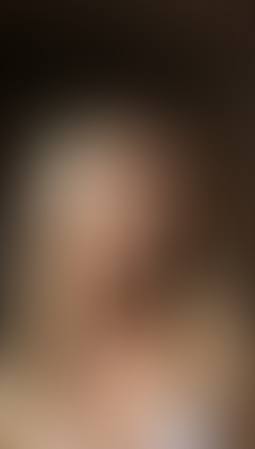 Geblurrte Content-Vorschau