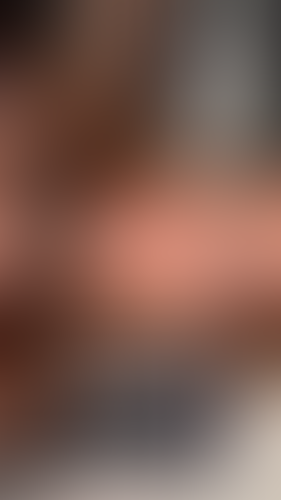 Geblurrte Content-Vorschau