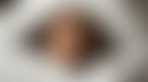 Geblurrte Content-Vorschau