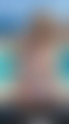 Geblurrte Content-Vorschau