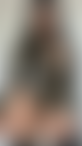 Geblurrte Content-Vorschau