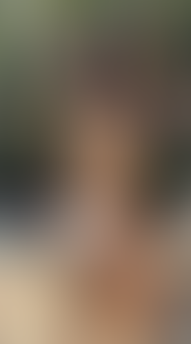 Geblurrte Content-Vorschau