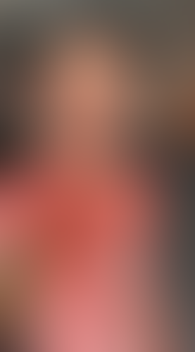 Geblurrte Content-Vorschau