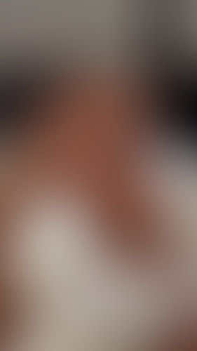 Geblurrte Content-Vorschau