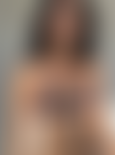 Geblurrte Content-Vorschau