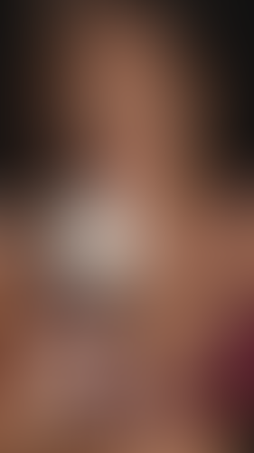 Geblurrte Content-Vorschau