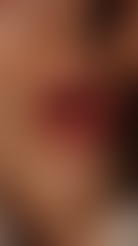 Geblurrte Content-Vorschau