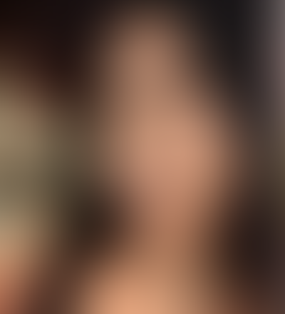 Geblurrte Content-Vorschau