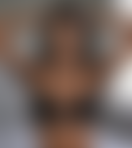 Geblurrte Content-Vorschau