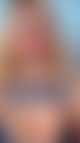 Geblurrte Content-Vorschau