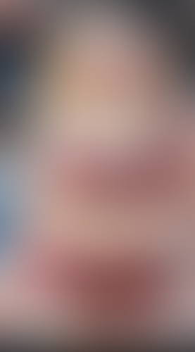 Geblurrte Content-Vorschau