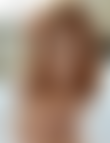 Geblurrte Content-Vorschau