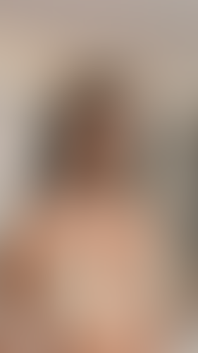 Geblurrte Content-Vorschau