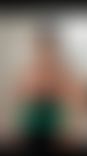 Geblurrte Content-Vorschau