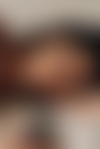 Geblurrte Content-Vorschau