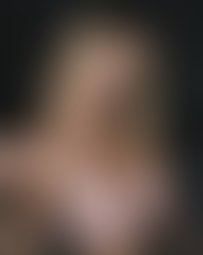 Geblurrte Content-Vorschau