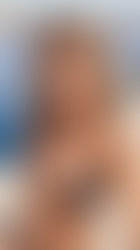 Geblurrte Content-Vorschau
