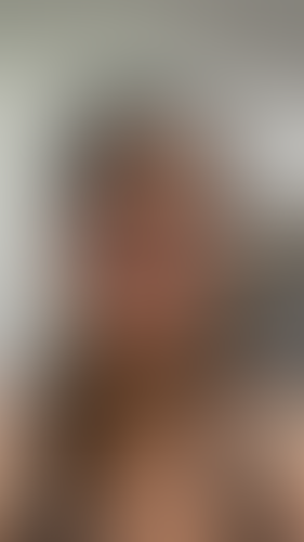 Geblurrte Content-Vorschau