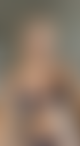 Geblurrte Content-Vorschau