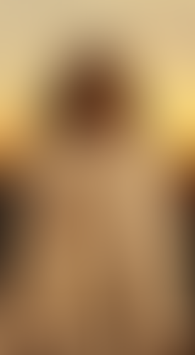 Geblurrte Content-Vorschau