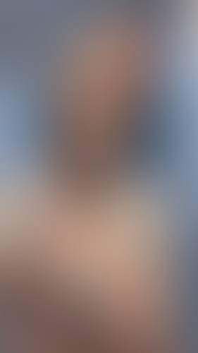 Geblurrte Content-Vorschau
