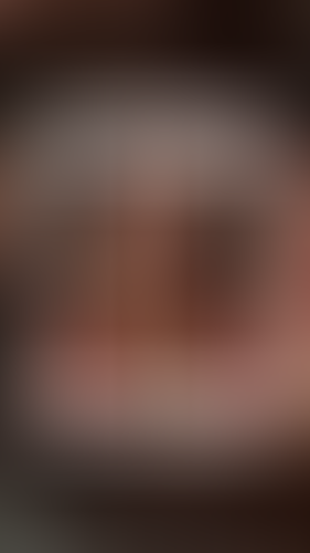 Geblurrte Content-Vorschau