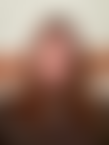 Geblurrte Content-Vorschau