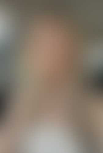 Geblurrte Content-Vorschau