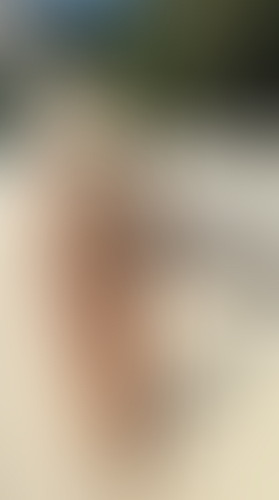 Geblurrte Content-Vorschau