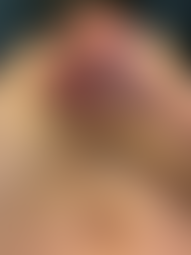 Geblurrte Content-Vorschau